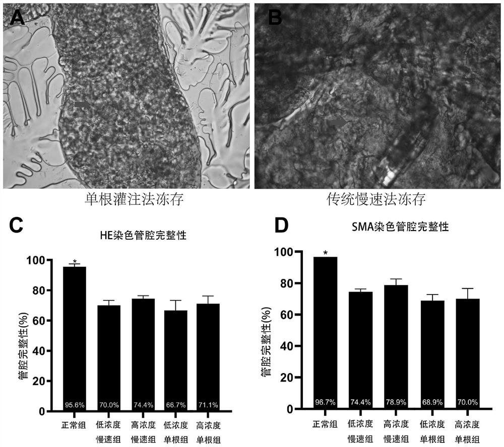 Testicular tissue cryopreservation method based on single seminiferous tubule perfusion