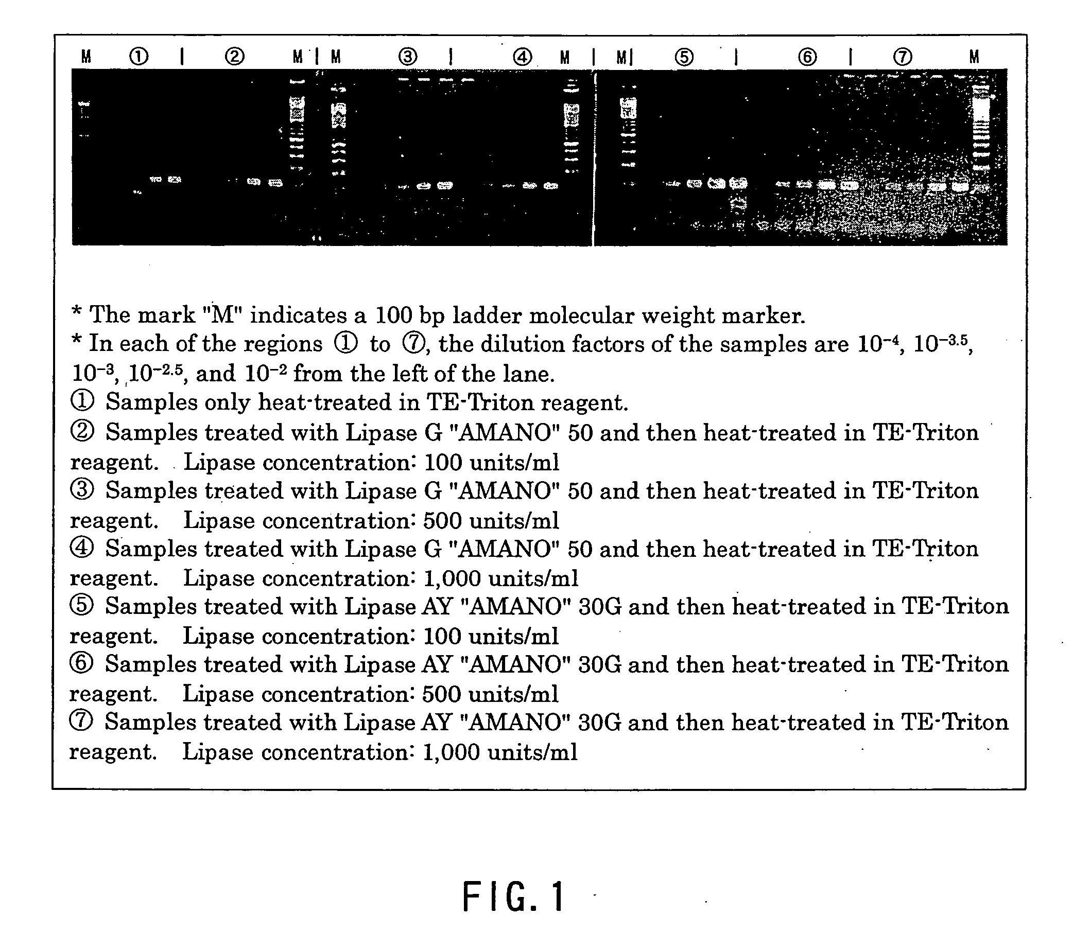 Method of effecting lysis of acid-fast bacteria and method of performing gene amplification or detection therewith