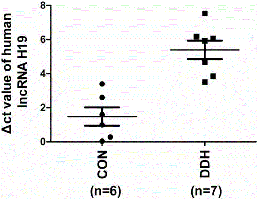 Application of long-chain non-coding RNA (ribonucleic acid) in treatment of DDH (developmental dysplasia of hip) disease