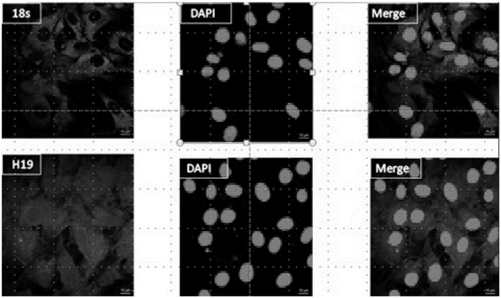 Application of long-chain non-coding RNA (ribonucleic acid) in treatment of DDH (developmental dysplasia of hip) disease