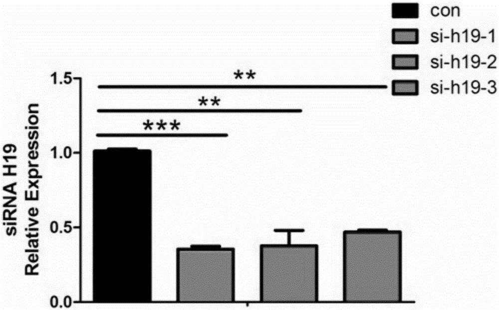 Application of long-chain non-coding RNA (ribonucleic acid) in treatment of DDH (developmental dysplasia of hip) disease