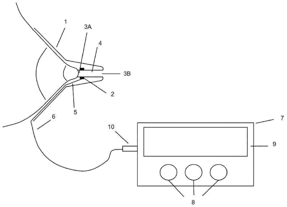 Microsensor-based breastfeeding volume measurement device