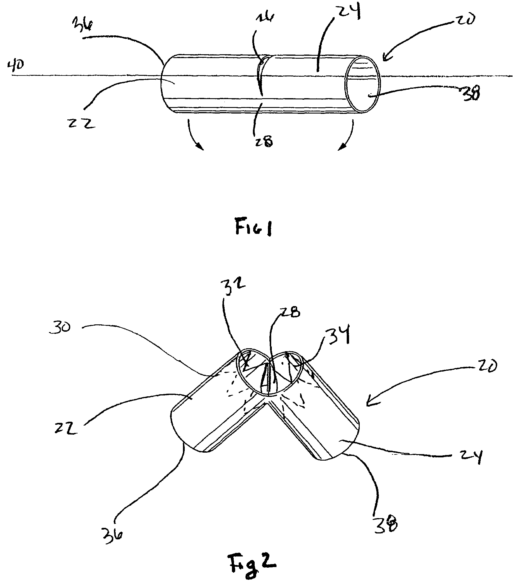 Endoluminal graft