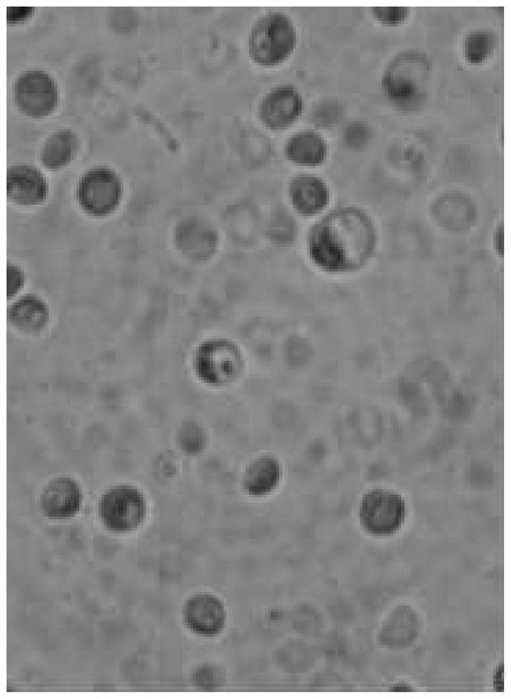 Fermentation method of chlorella, fermented product and composition comprising fermented product of chlorella