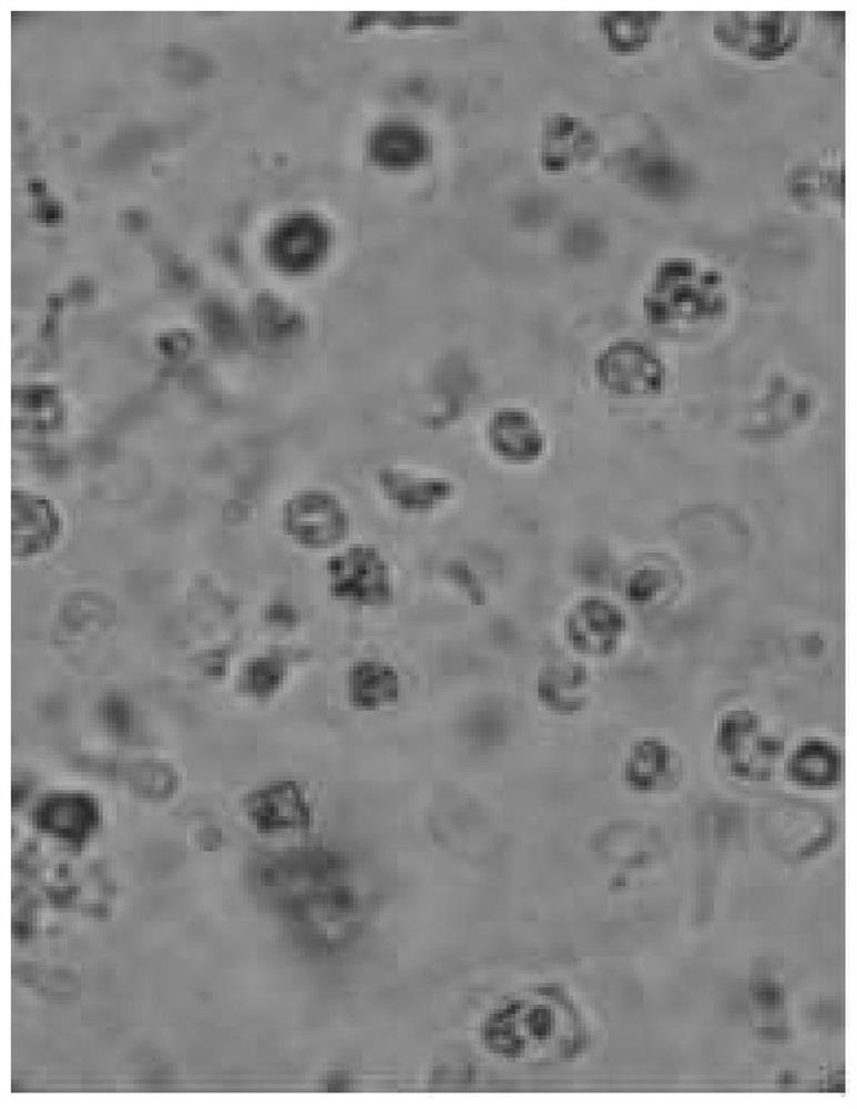 Fermentation method of chlorella, fermented product and composition comprising fermented product of chlorella