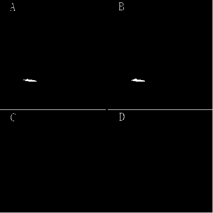 A kind of image processing method and device for suppressing fat signal