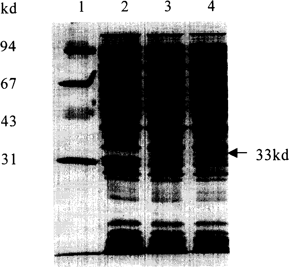 Antihuman transferrin acceptor human source antibody and uses thereof