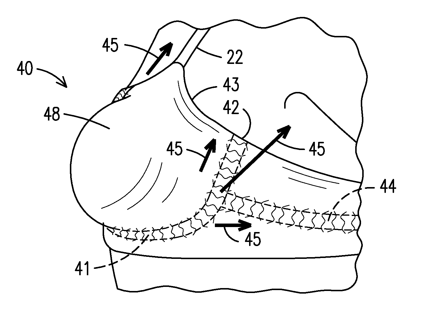 Breast shaping and lifting support garment