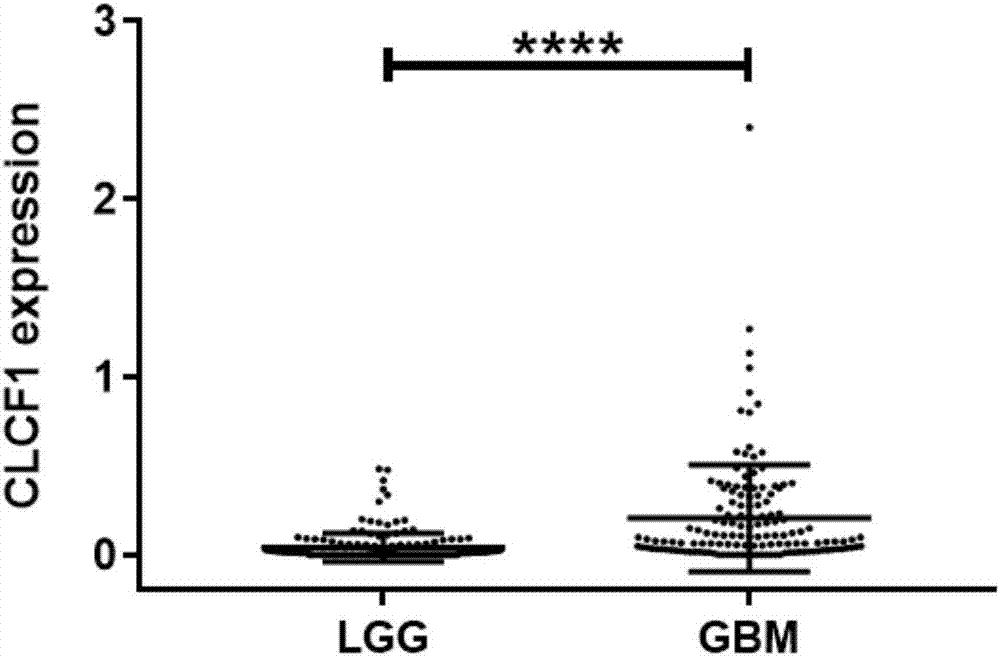 Kit for aided-diagnosis and prognostic evaluation on glioblastoma based on gene CLCF1 and use method thereof