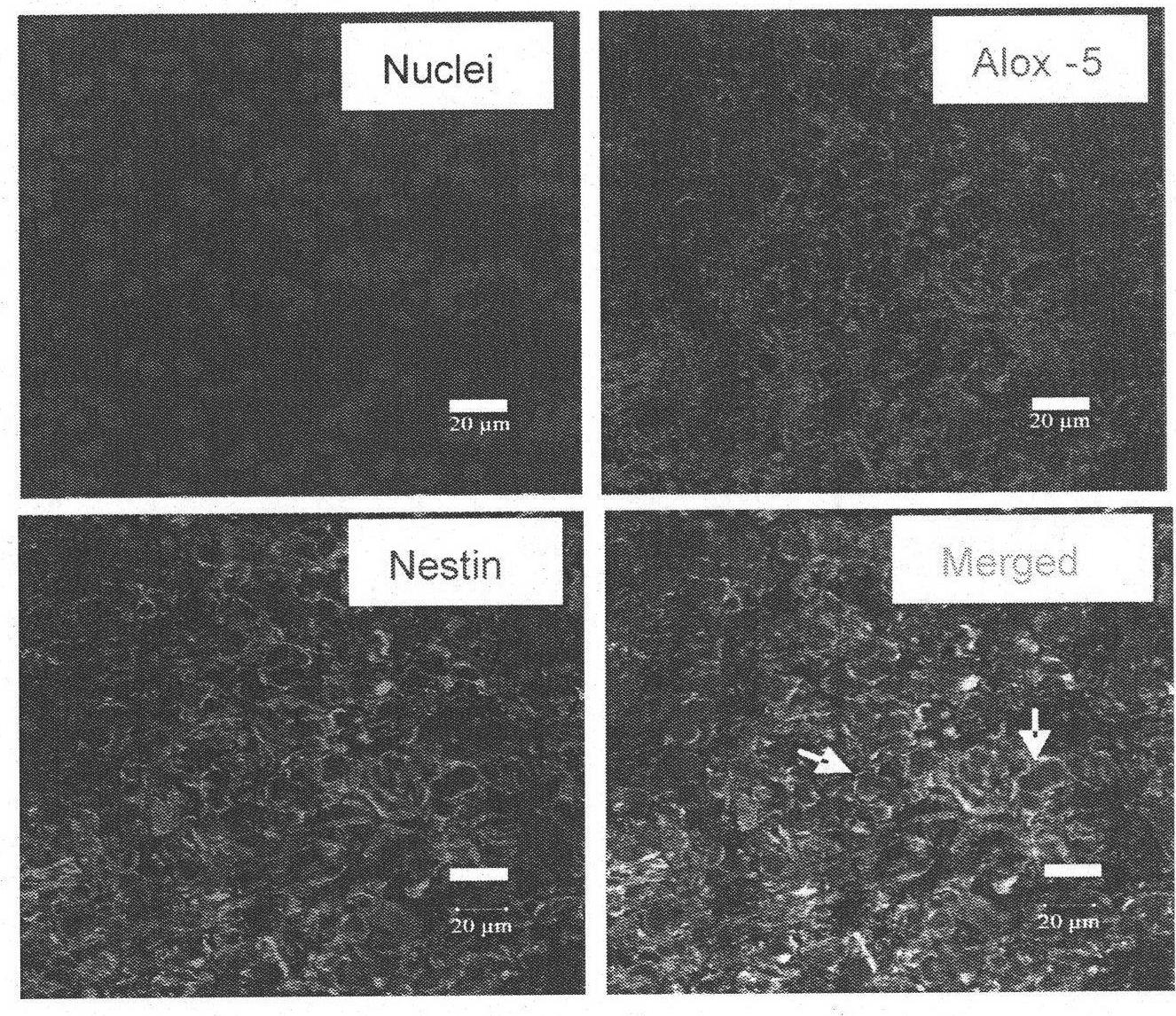 Application of nordihydroguaiaretic acid in preparing drug capable of resisting tumour stem cells