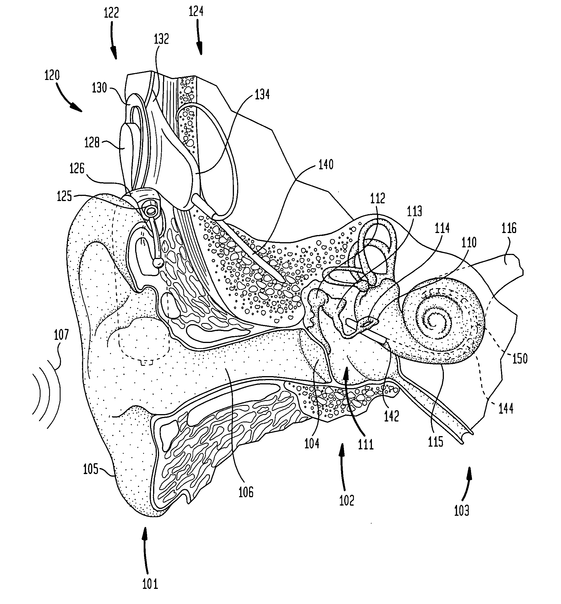 Stimulating auditory nerve fibers to provide pitch representation