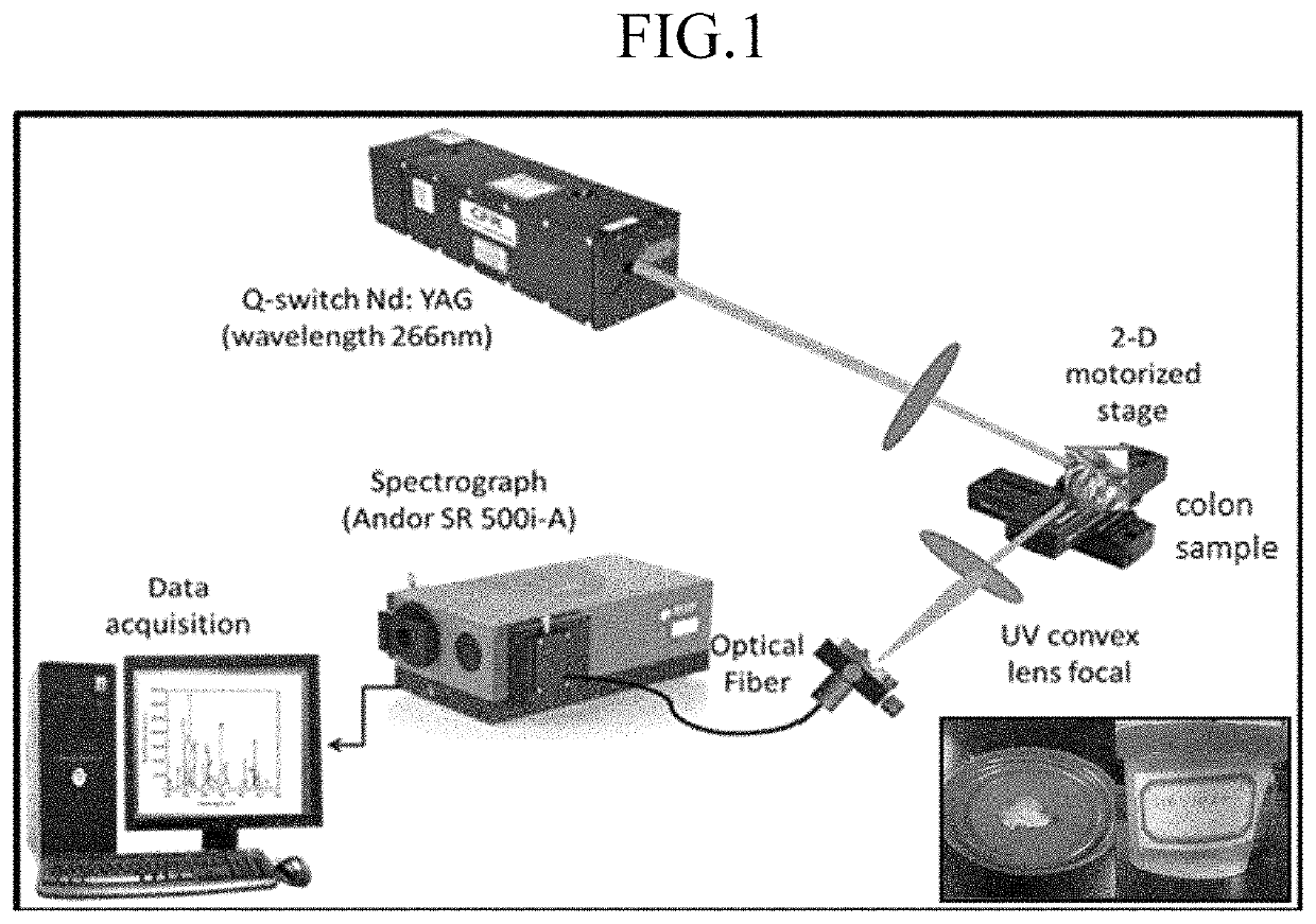 Method for detecting and treating colon cancer by measuring heavy metal concentrations