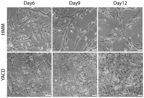 Culture medium and culture method for hepatocytes and application of hepatic cells