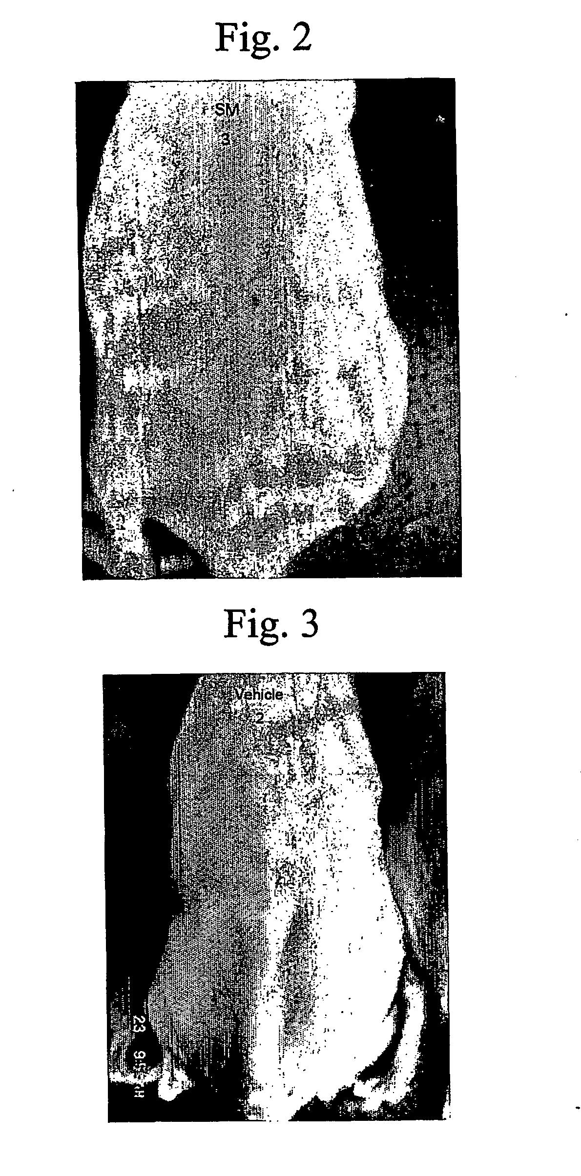 Composition for Protecting Skin