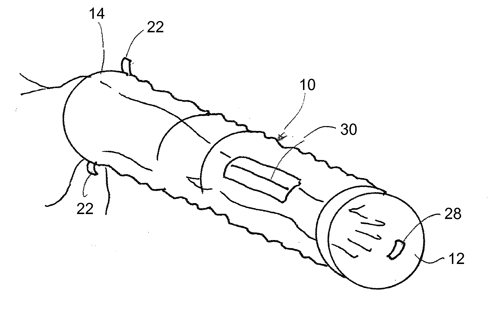 Disposable radial access catheterization sleeve