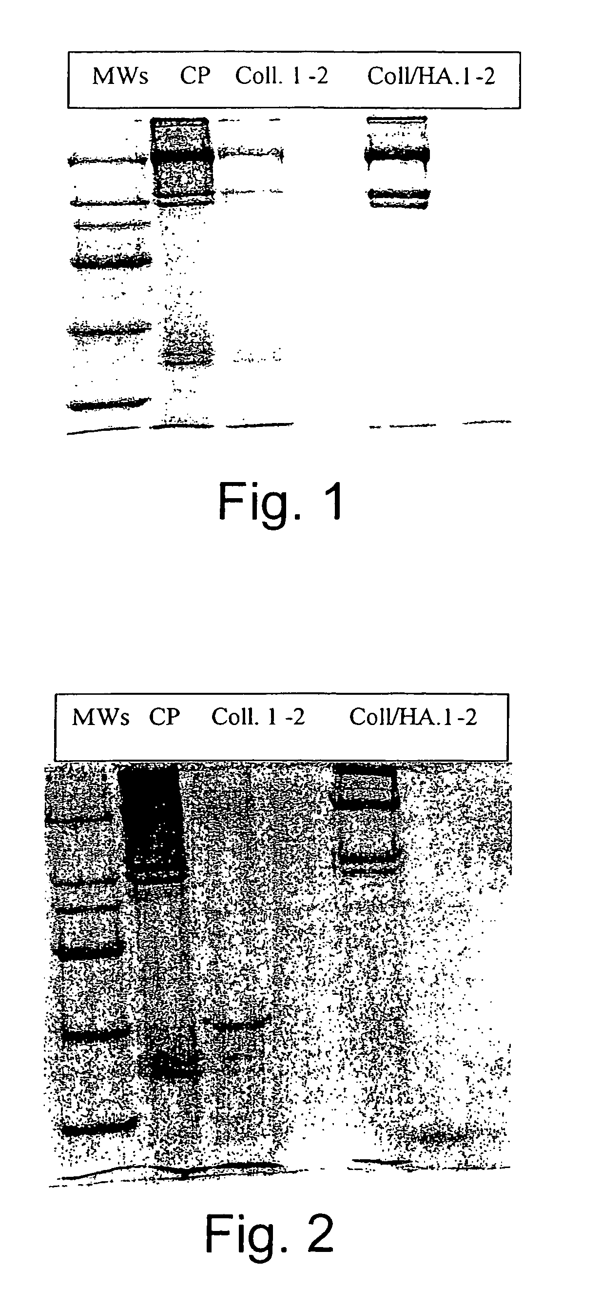 Pharmaceutical compositions containing hyaluronic acid and collagenase for the topical treatment of wounds, burns and ulcers