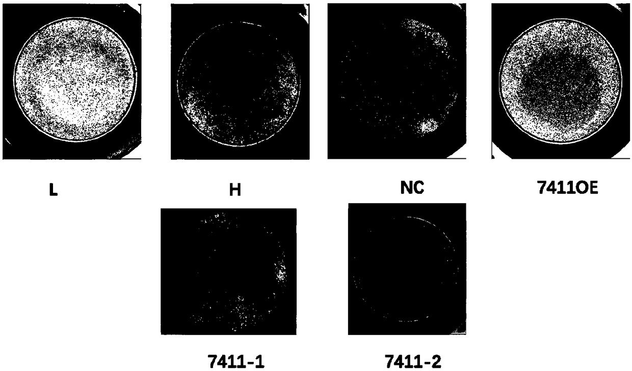 Application of circRNA in field of angiogenesis inhibition