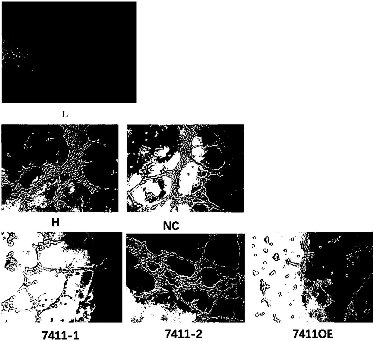 Application of circRNA in field of angiogenesis inhibition