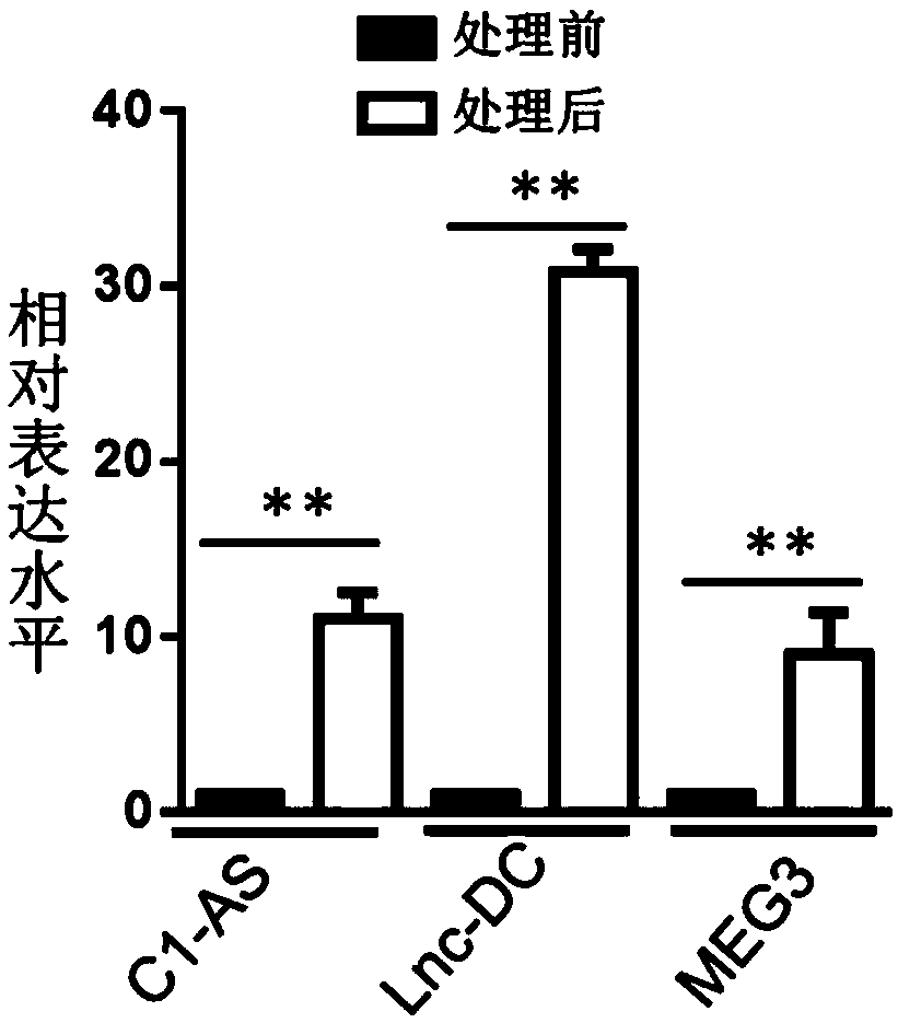 Application of non-coding RNA molecule Lnc-DC in predicting drug resistance of tamoxifen in breast cancer