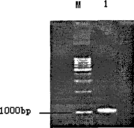 Improved Rhizomucor miehei lipase gene and use thereof in yeast display