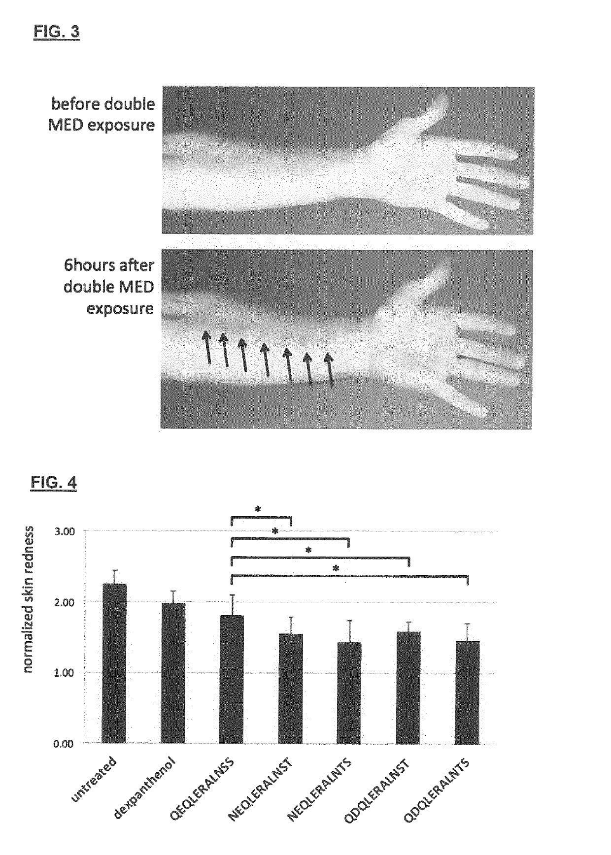 Cosmetic formulations for topical applications containing erythropoietin-derived molecules