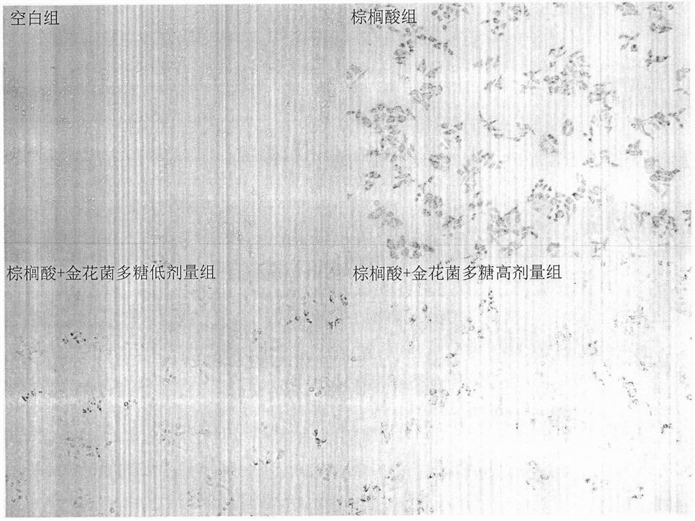 Method for evaluating activity of dietary polysaccharide