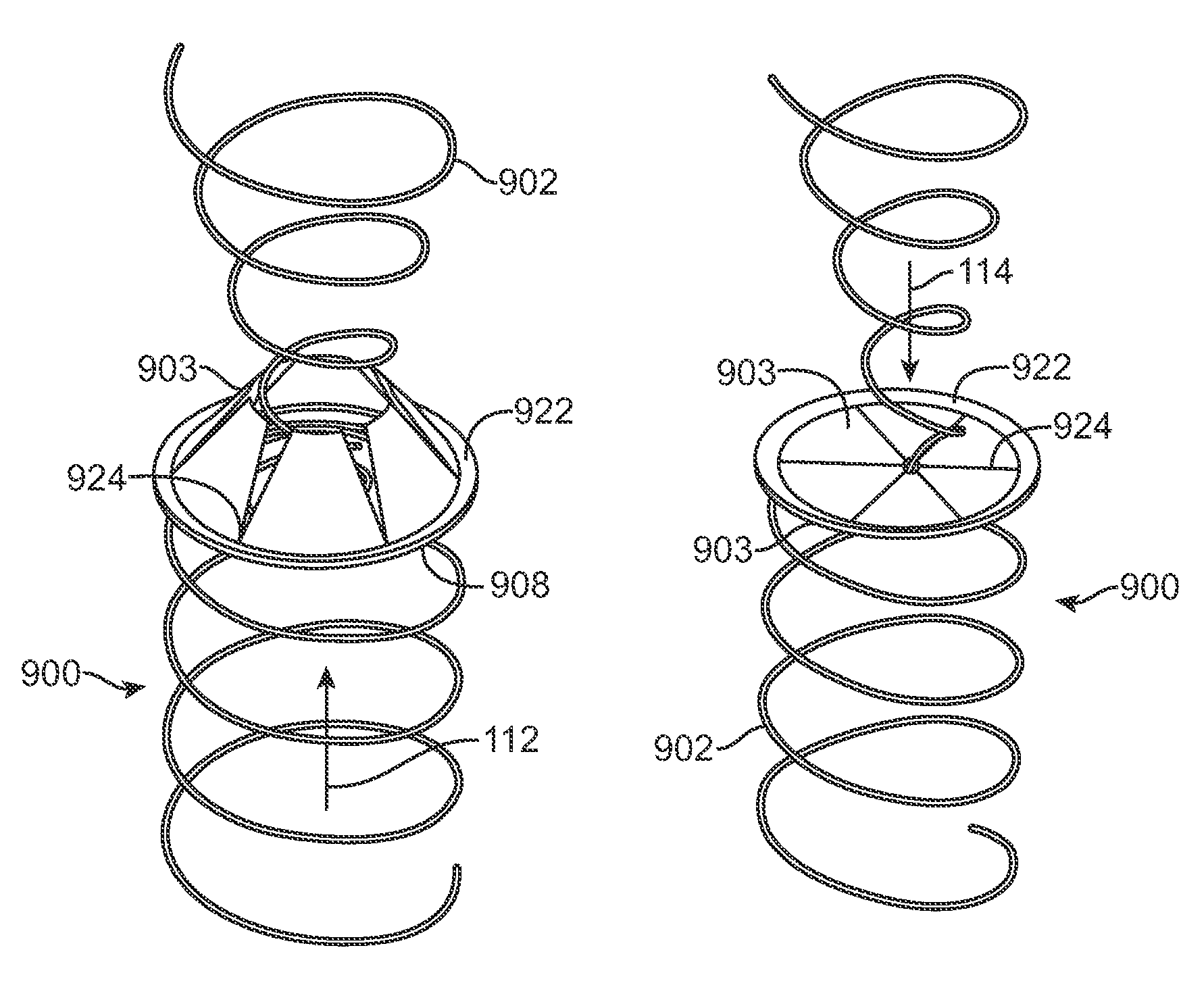 One-way replacement valve