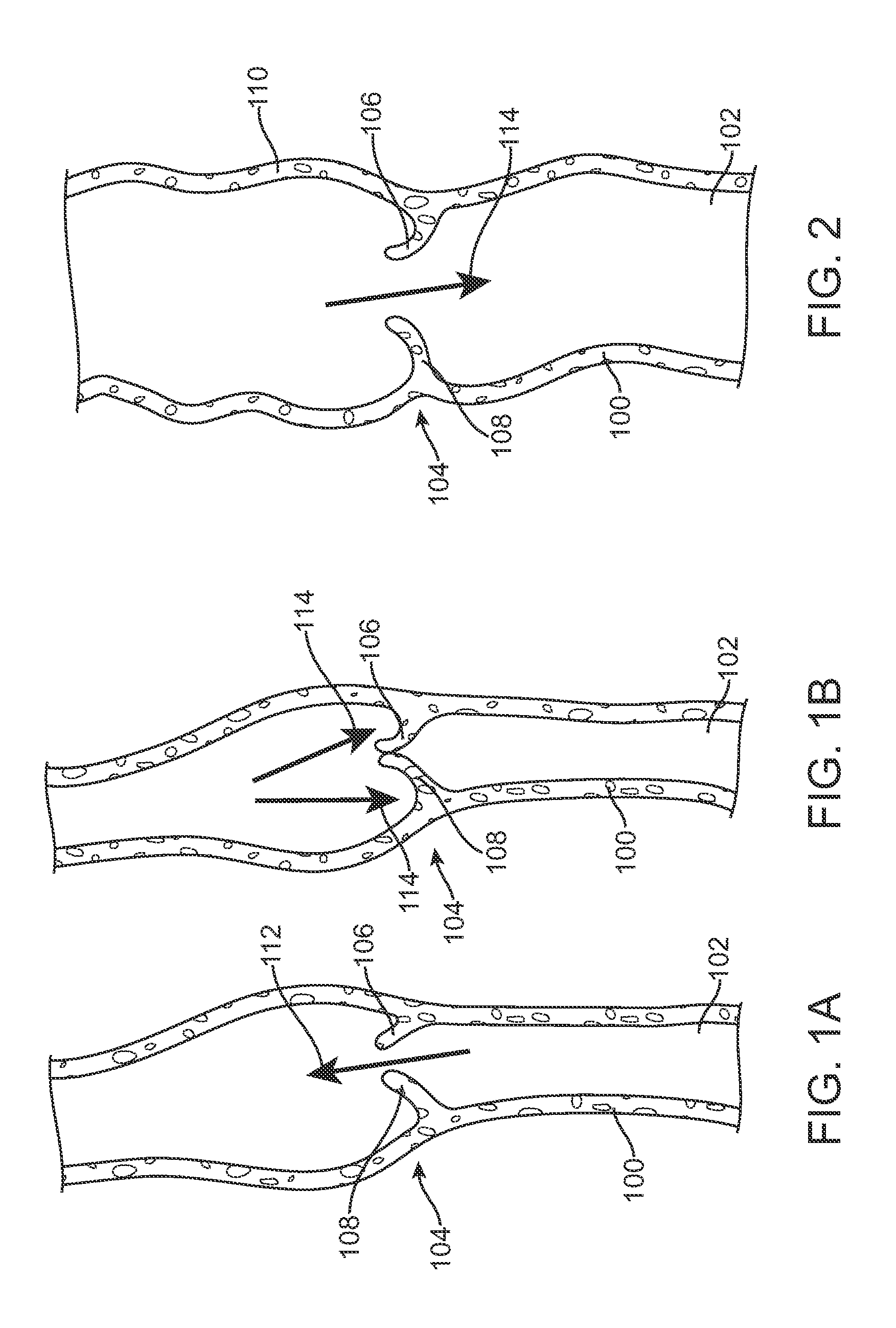 One-way replacement valve