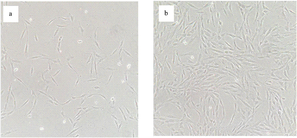 Method for preparing adipose derived stem cell bioactive peptide freeze-dried powder