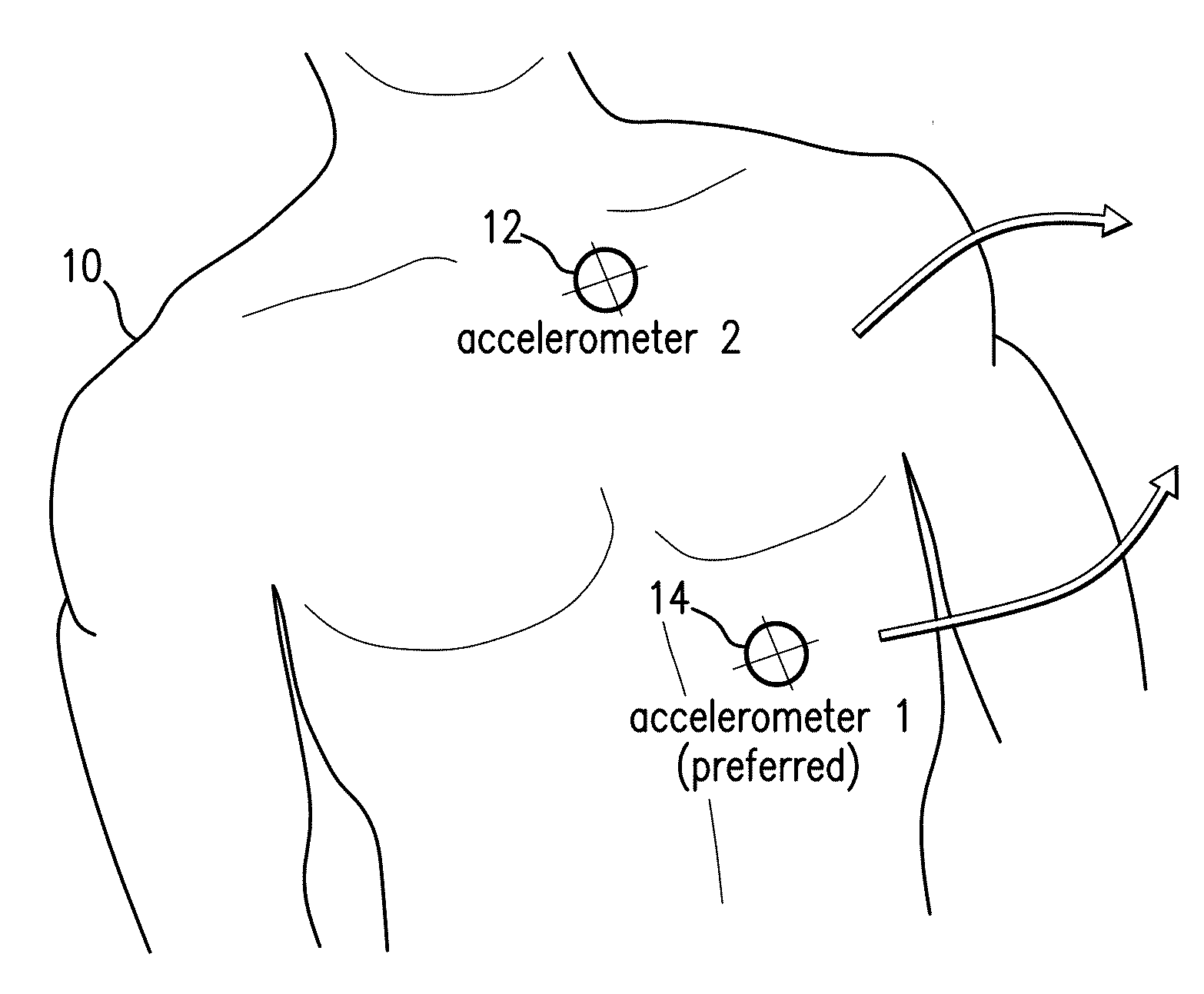 Body-worn monitor for measuring respiration rate