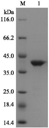 Acinetobacter Y-3L-asparaginase gene as well as expression and application thereof