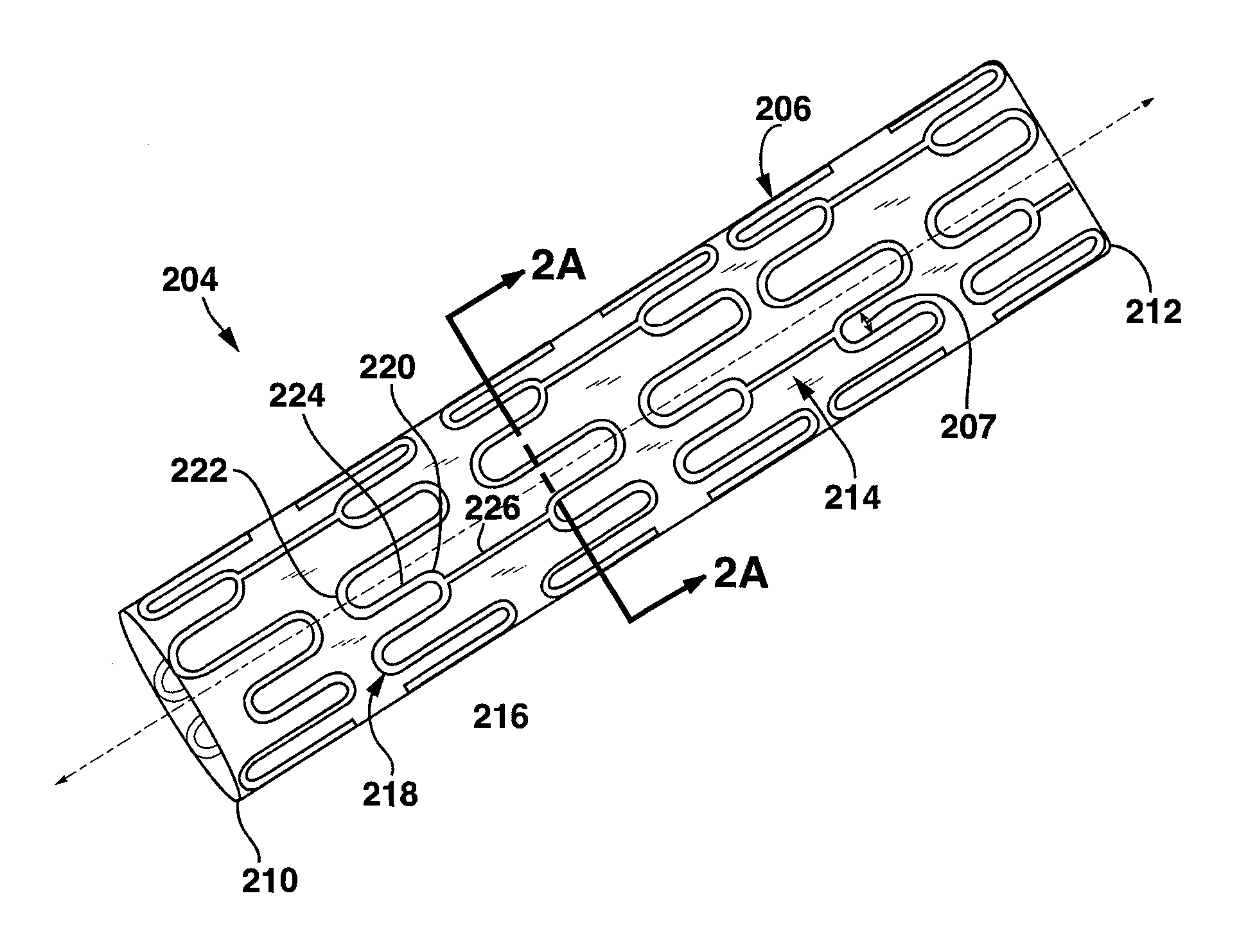 Implantable Venous Valve for Treatment of Erectile Dysfunction