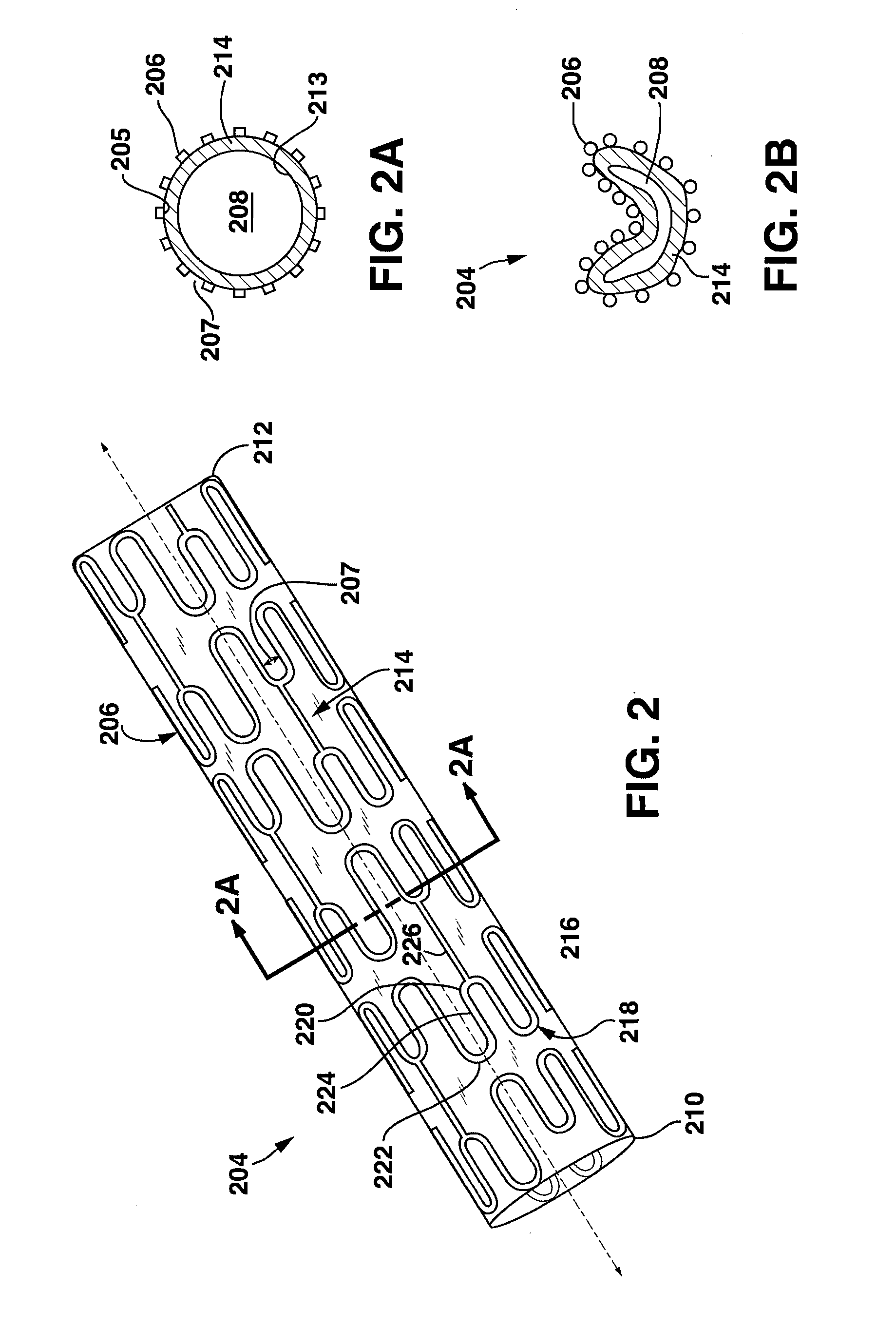 Implantable Venous Valve for Treatment of Erectile Dysfunction