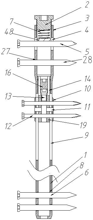 Novel bone transport intramedullary nail