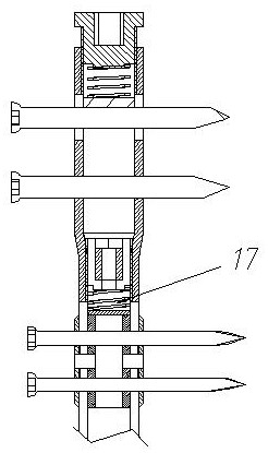 Novel bone transport intramedullary nail