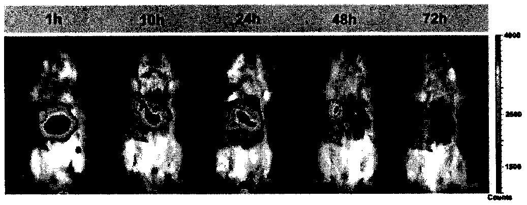 Pharmaceutical composition nano-system for anti-tumor immunotherapy