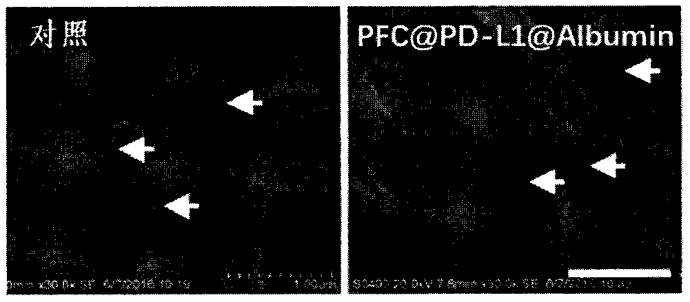 Pharmaceutical composition nano-system for anti-tumor immunotherapy