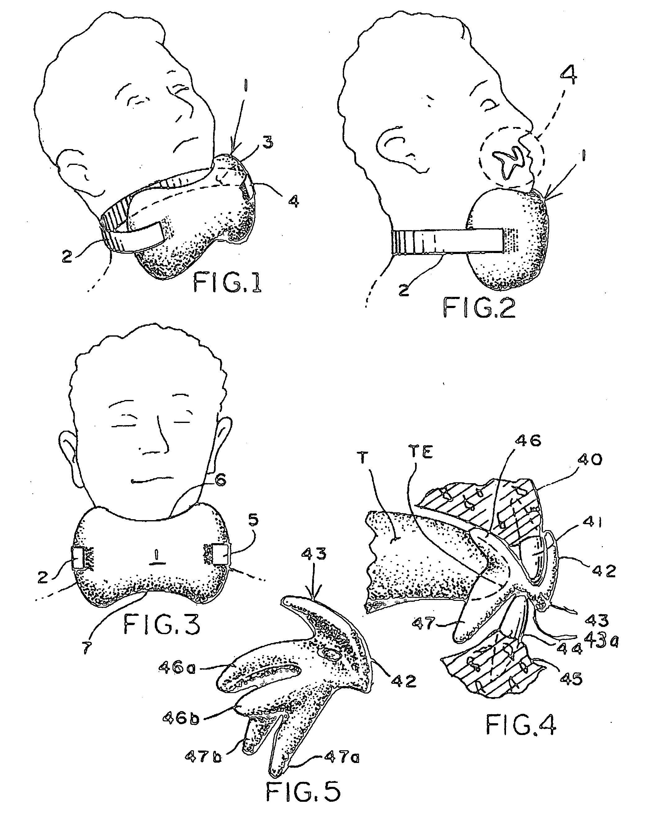 System to alleviate snoring