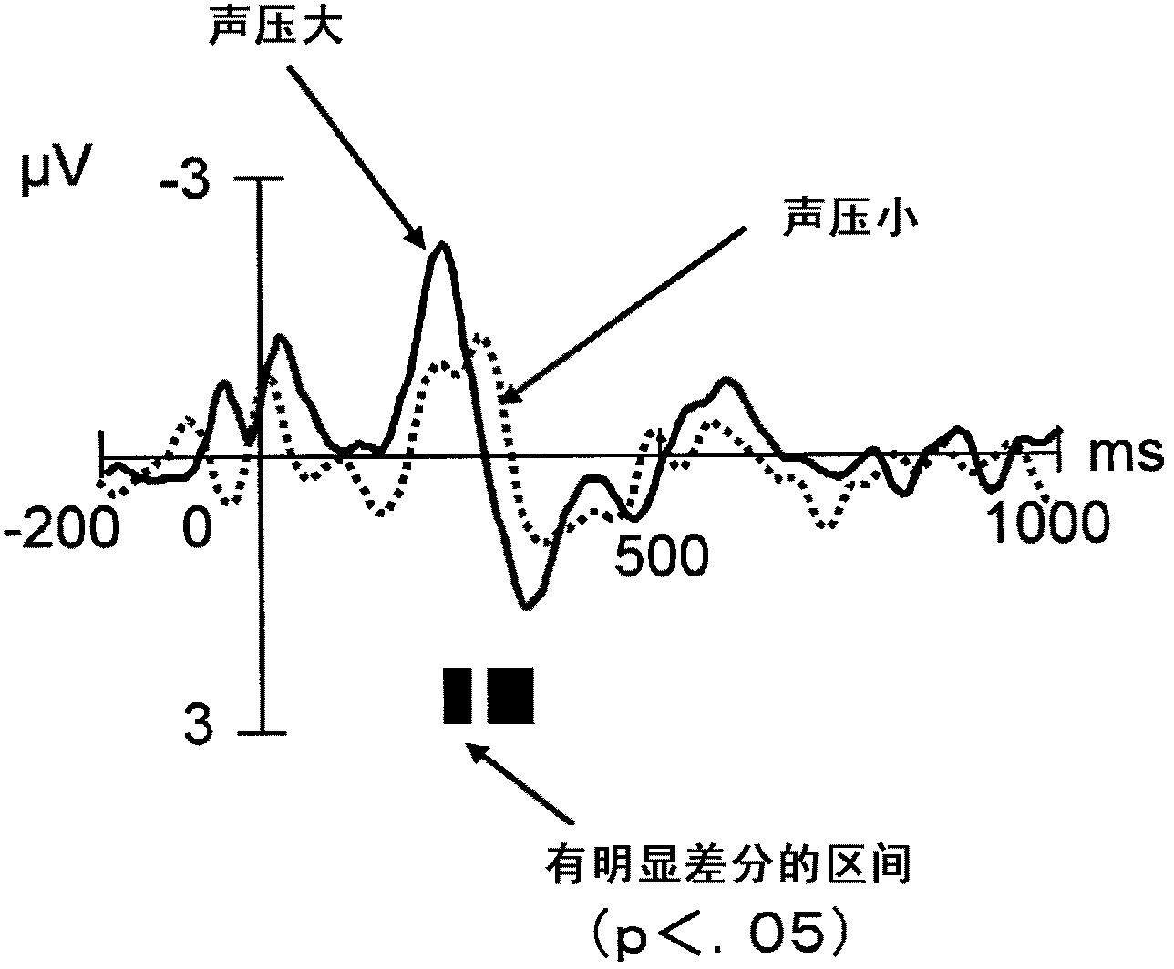 Electroencephalograph, hearing aid, electroencephalogram recording method and program for same