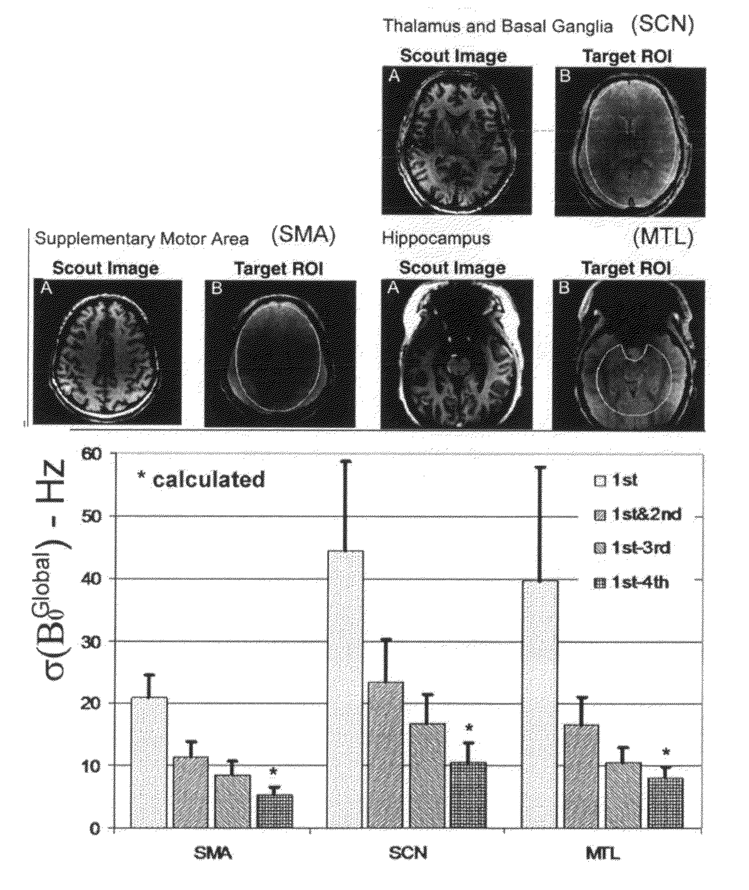 Shim insert for high-field MRI magnets