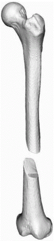 Computer-assisted fracture restitution degree measurement method