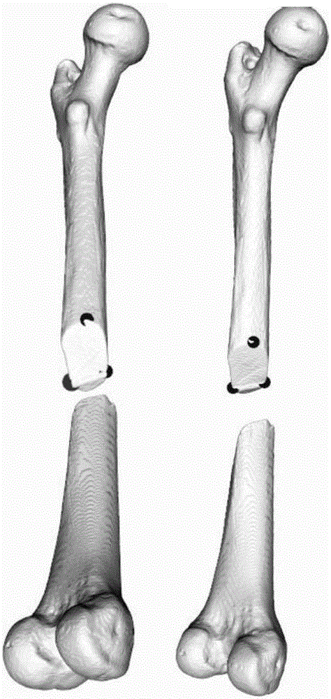 Computer-assisted fracture restitution degree measurement method