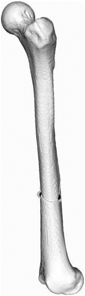 Computer-assisted fracture restitution degree measurement method