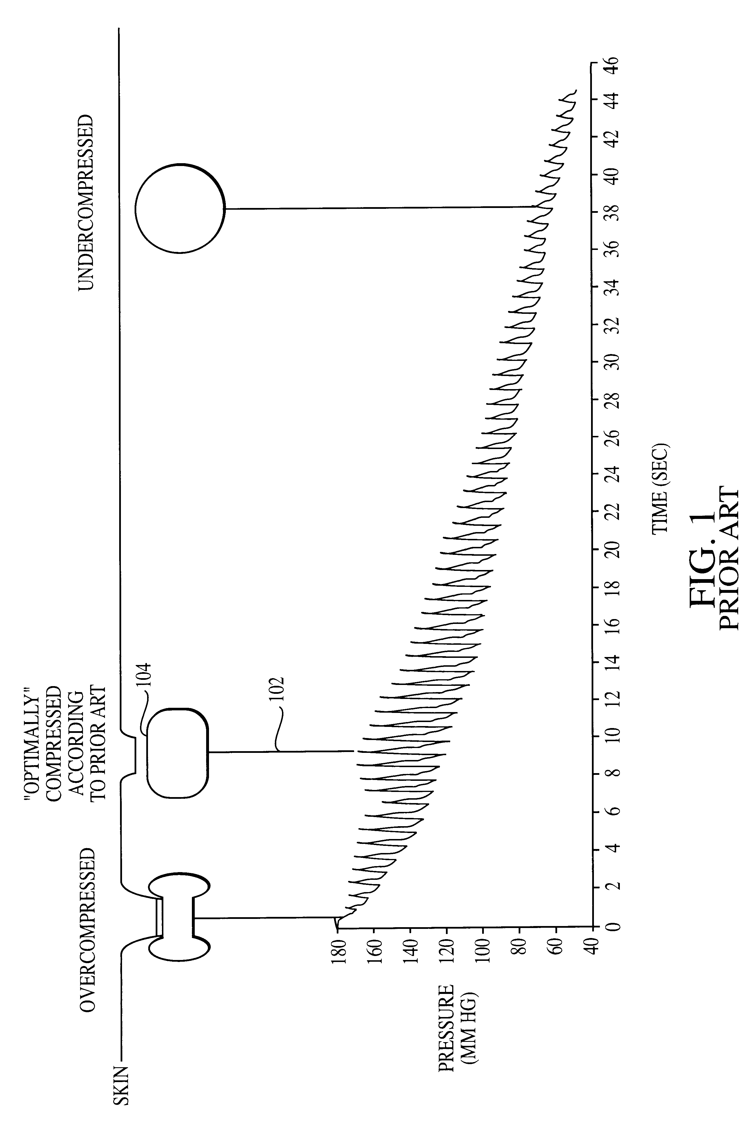 Method and apparatus for the noninvasive determination of arterial blood pressure