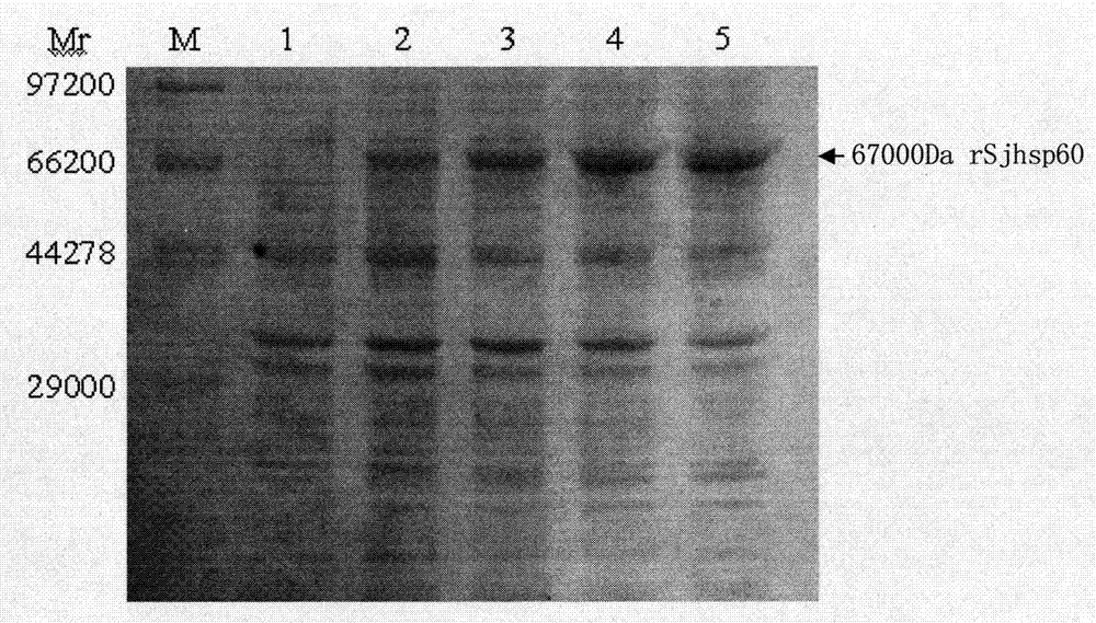 Recombinant expression carrier containing schistosoma japonicum gene and application thereof