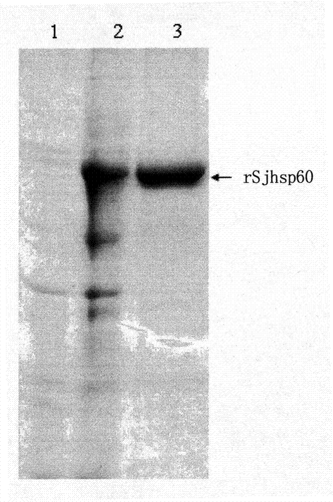 Recombinant expression carrier containing schistosoma japonicum gene and application thereof