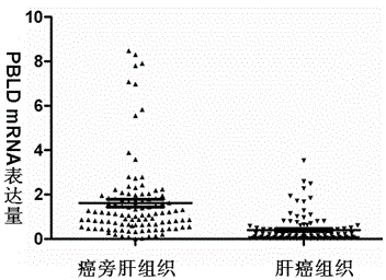 PBLD gene expression primer for primary hepatoma treatment scheme selection and/or prognosis assessment, and application thereof