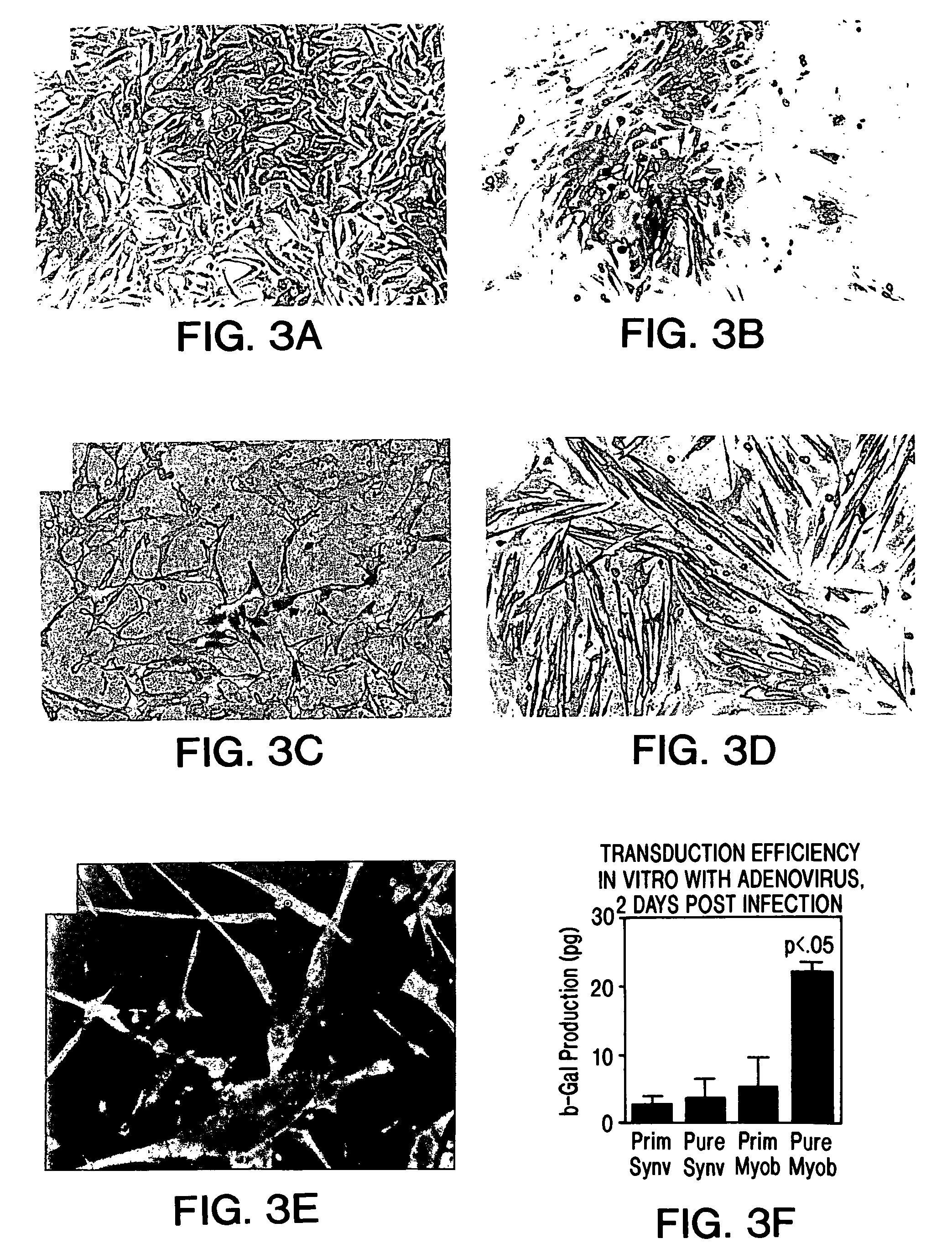 Muscle-derived cells (MDCs) for treating muscle- or bone-related injury or dysfunction