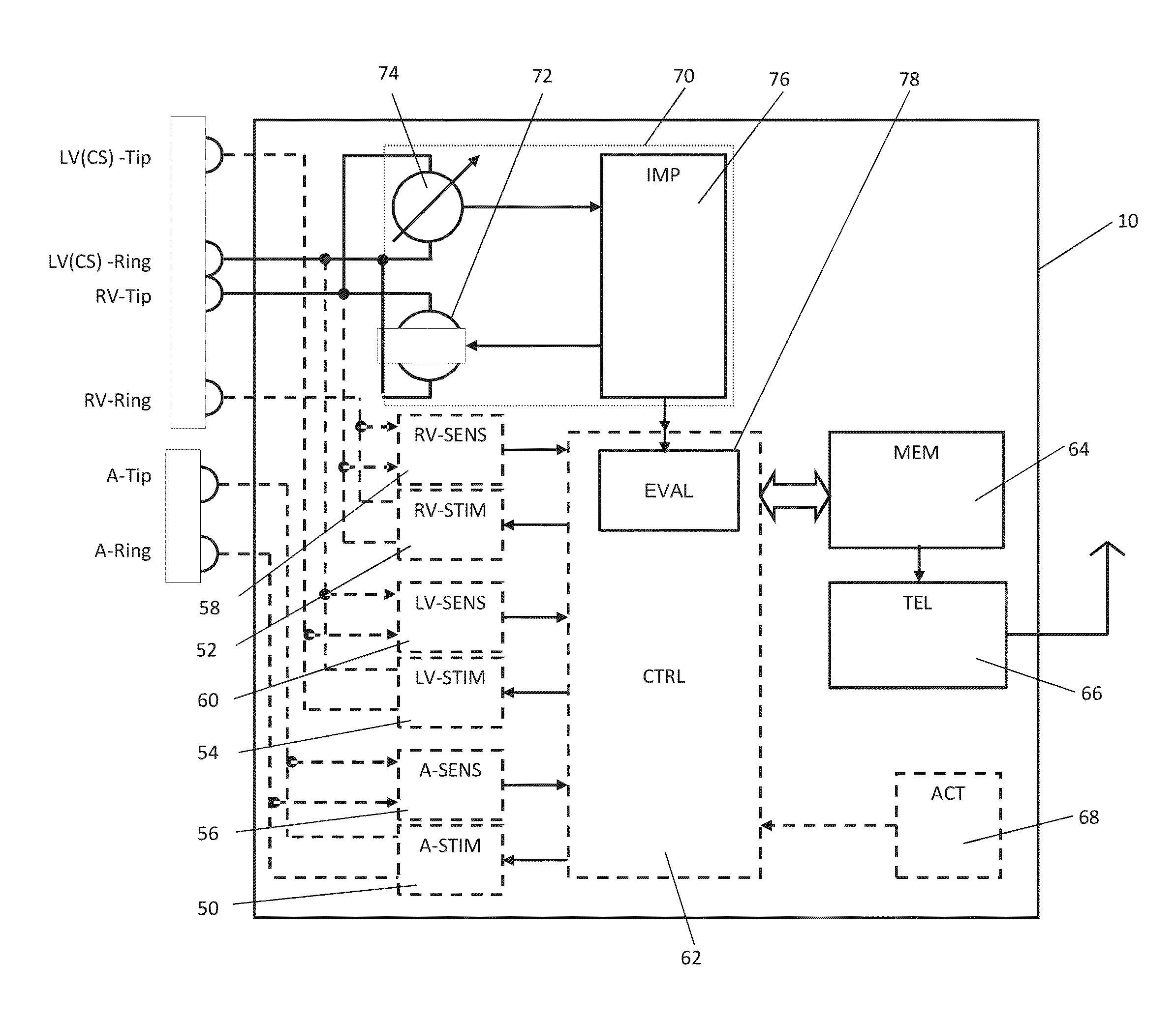 Apparatus and method to optimize pacing parameters