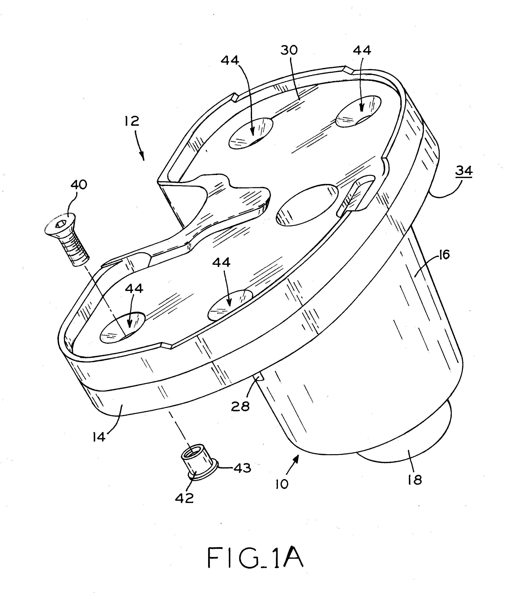 Stabilizing prosthesis support structure